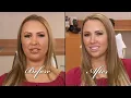 Wife of Hot Felon Jeremy Meeks Gets Smile Makeover