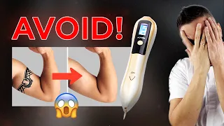 The unpleasant truth about Plasma Pen for Tattoo and Permanent Makeup Removal