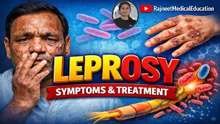 Leprosy | Causative agent | Incubation period | Types | Sign & symptoms | Tests | Treatment