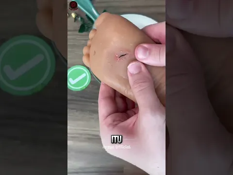 Kakimu Tertusuk Pecahan Kaca? Lakukan Ini 😱