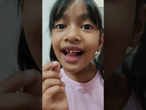 Uda goyang goyang 🦷
