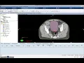 Eclipse Graphical User Interface and Toolbars