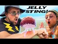 Stinging myself with Jellyfish to get Family Reactions PRANK