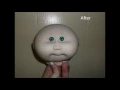 Cabbage Patch Pox Part 2