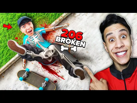 Video Thumbnail: تحدي تكسير العظام الي يكسر عظمة اكثر يفوز ام كامل وسحس الفأر🦴😂 - Skate
