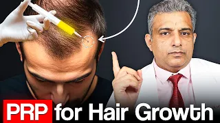 PRP Hair Loss Treatment Before and After Success Stories
