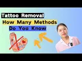 Tattoo Removal What Methods Do You Know Except Laser Tattoo Removal