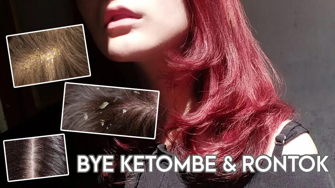 BEST HAIRCARE 2020 MENGATASI RAMBUT RONTOK DAN KETOMBE BIKIN RAMBUT LEMBUT LEBAT MUDAH DIATUR WANGI. 