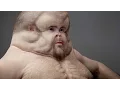 Making a crash-proof human - Behind the News