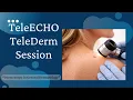 TeleECHO TeleDerm Session 13 - Dermoscopy in General Dermatology