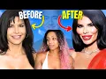 Plastic Surgery Is Not Worth It