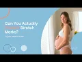 Can You Actually Prevent Stretch Marks