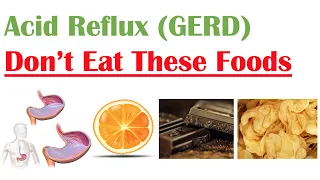 Worst Foods to Eat with Acid Reflux GERD Gastroesophageal Reflux Disease How to Reduce Symptoms