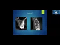 Utilizing Advanced Endodontic Techniques and Technology to Enhance Root Canal Success