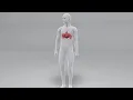 Hiatal Hernia Repair Animation