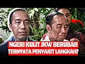 Download Lagu SAKIT JKW LANGKAH‼NETIZEN BILAH ITU KARMA DARI RAKYAT…