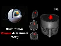 3D Slicer Tutorial 2026 Brain Tumor MRI Segmentation Volume Calculation 3D Model