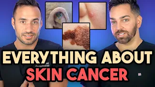 Everything About Skin Cancer: Prevent, Identify, Biopsy, and Treatment | Dermatologist Explains
