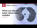 What you should know about lung nodules Ohio State Medical Center