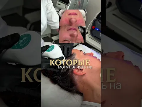 Понятная схема ухода в результате #longevity