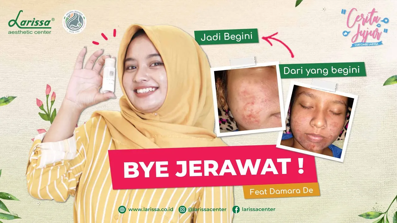 NATASHA SKINCARE | PERTAMA KALI | BIAYANYA | REVIEW. 
