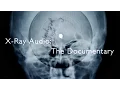 Download Lagu X-Ray Audio: The Documentary