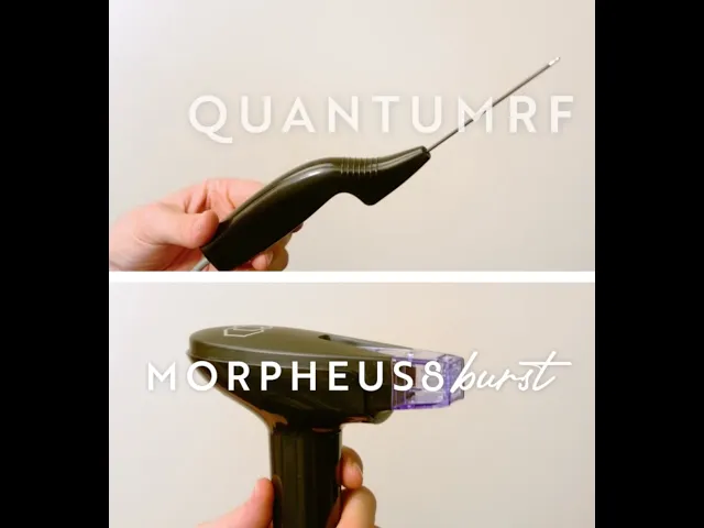 Dr. Forley discusses QuantumRF & Morpheus8 Burst for skin tightening