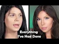 What Happened to Blaire White s Face All The Work I ve Had Done