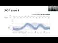 Interpretation of CGM by Dr Ganesh Jevalikar PDU2020