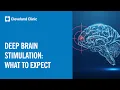 Deep Brain Stimulation What To Expect