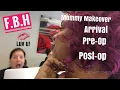 MOMMY MAKEOVER ARRIVAL PRE-OP POST-OP DR DOWBAK NEW CLINIC