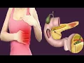 Pain Under Left Breast Causes And Symptoms