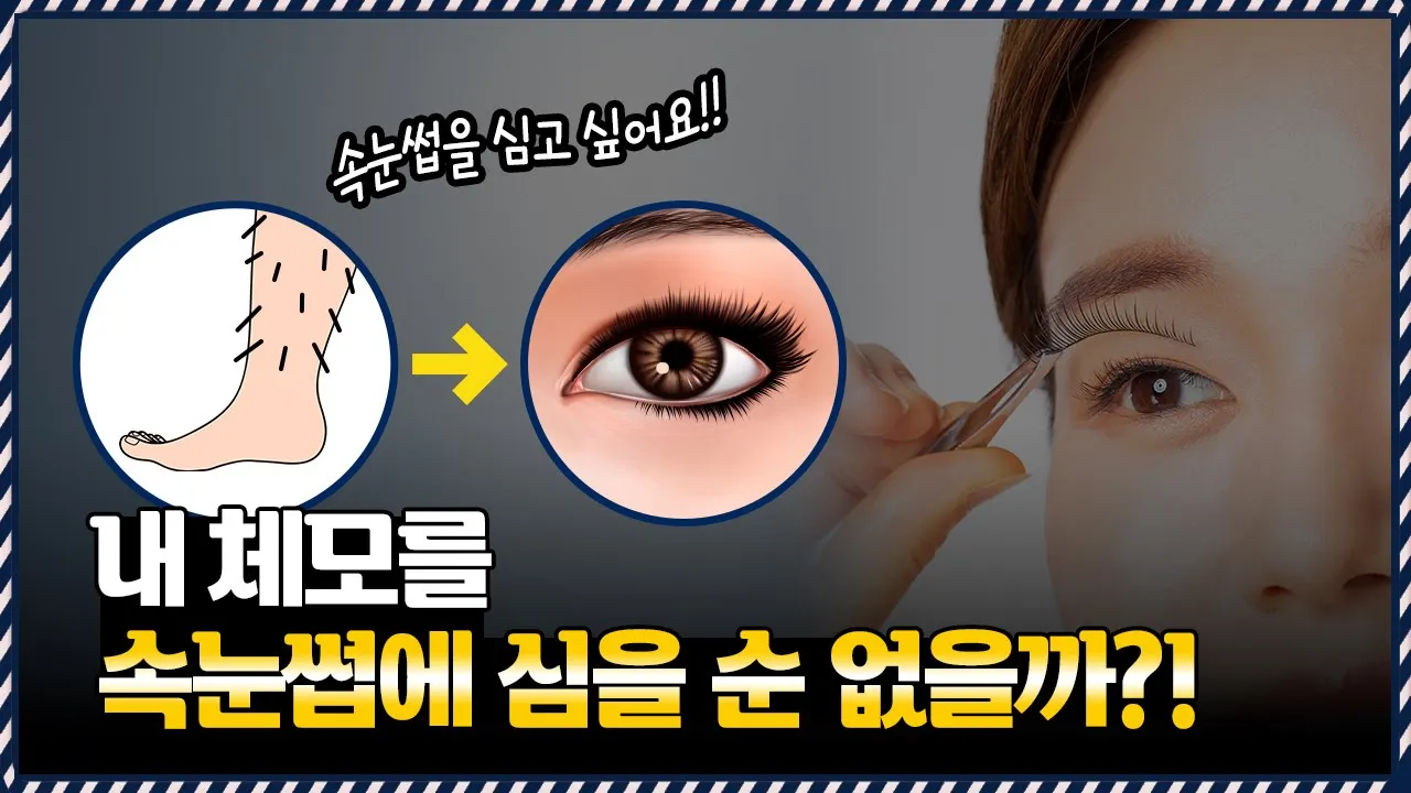 의느님답변📂속눈썹에 머리카락 이식했더니... 😱속눈썹을 심고 싶어요!!!ㅣ다나성형외과(DANA)ㅣ모발이식ㅣ헤어라인교정ㅣ두피문신ㅣ탈모치료