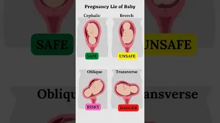 Presentation And Baby S Lie During Pregnancy Shorts 