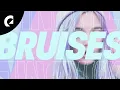Download Lagu Mindme - Bruises (Official Album) [Pop Music]