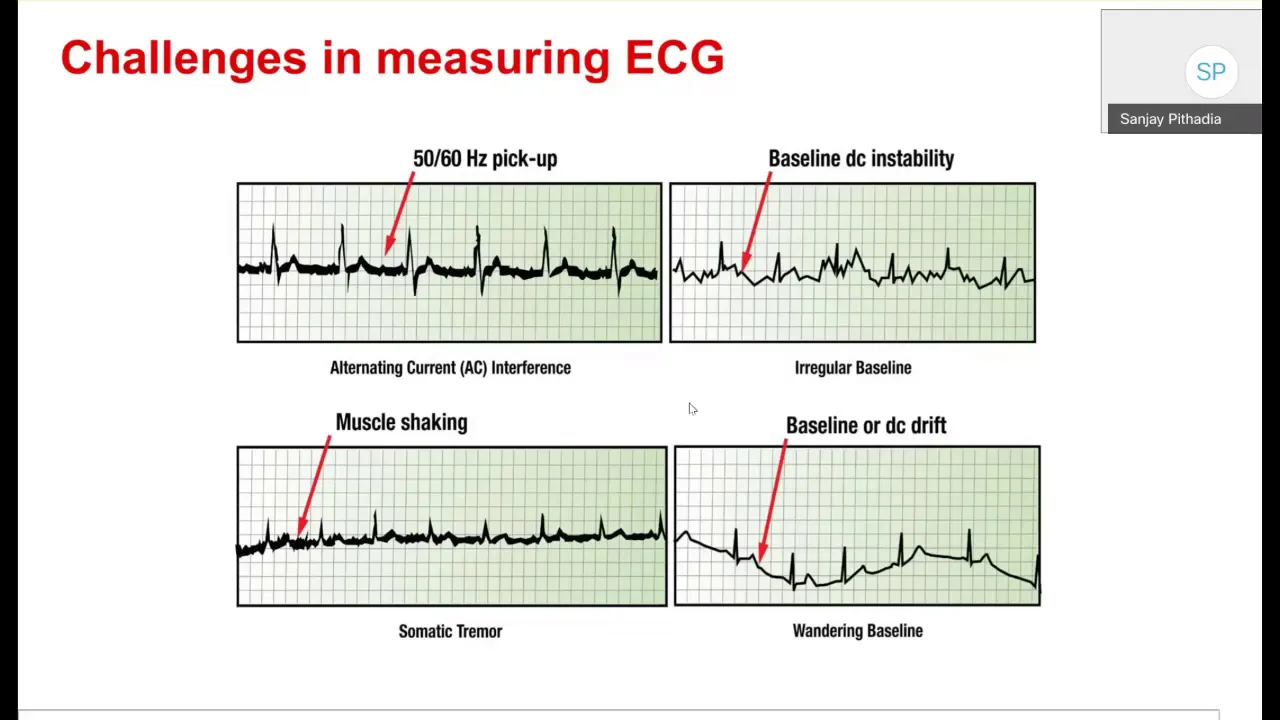 Design & Differentiate “Patient Monitoring & Ventilation” Systems with TI Solutions