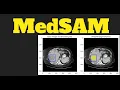 MedSAM Segment Anything in Medical Images Universal medical image segmentation