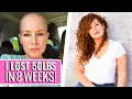 Download Lagu Stage 4 Stomach Cancer Took My Modeling Career - Maria | Stage 4 Stomach Cancer | The Patient Story