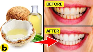 Here s How You Get Sparkling Teeth In Under 20 Minutes