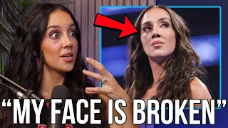Chelsea Green On Breaking Her Orbital Bone
