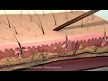 Inflammation: Immune Response to Tissue Injury or Infection