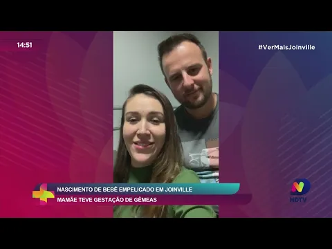 Nascimento de bebê empelicado em Joinville: mamãe teve gestação de gêmeas