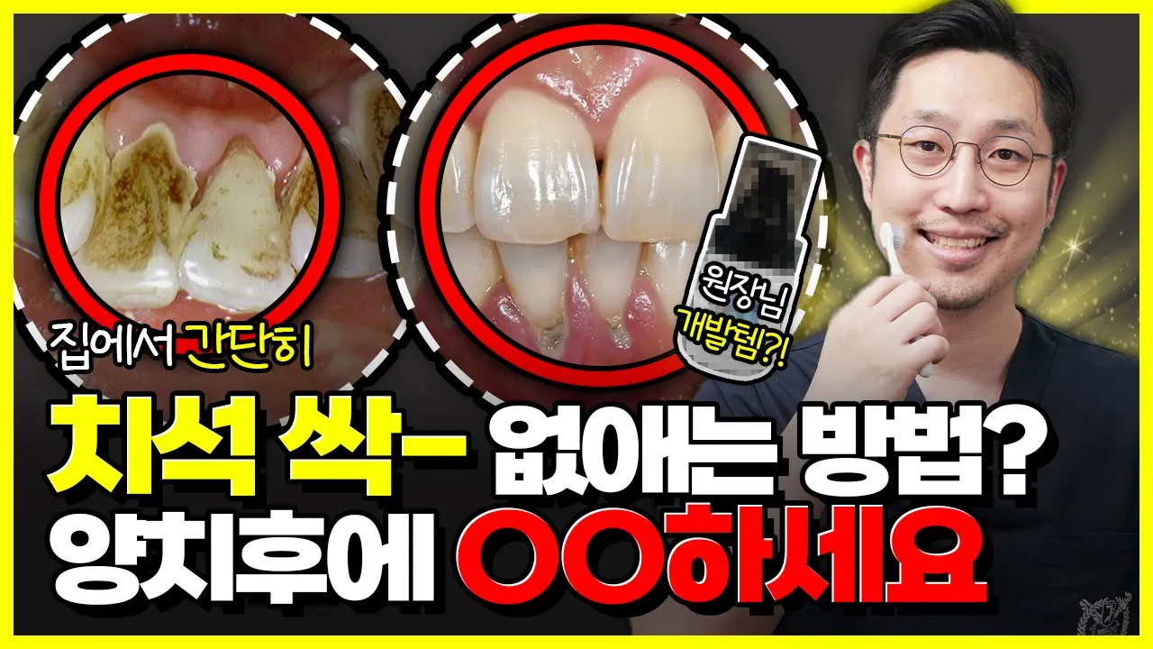 치석 없애는 방법에는 이게 직빵입니다 (치석 잘생기는 사람 필수시청)
