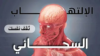 ما هو الالتهاب السحائي    أنيميشن توضيحي  دندنها
