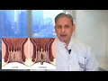 Painful Anal Fissure - The 15 seconds treatment