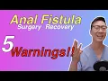 Download Lagu 5 problems after Anal Fistula surgery!! Watch for these!
