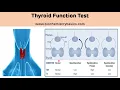 Thyroid Function Test Biochemistry Thyroid Hormones TFT