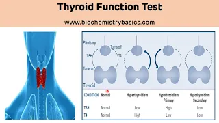 Thyroid Function Test Biochemistry Thyroid Hormones TFT