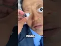 Lagu Papa look he is putting a fake eye in our uncle's eye 😲😱 #shorts #eyes