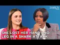 She Lost Her Hand and Leg in a Shark Attack